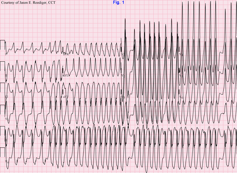 Latest WOLFF Updates visual data 3